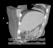 animated liver surface